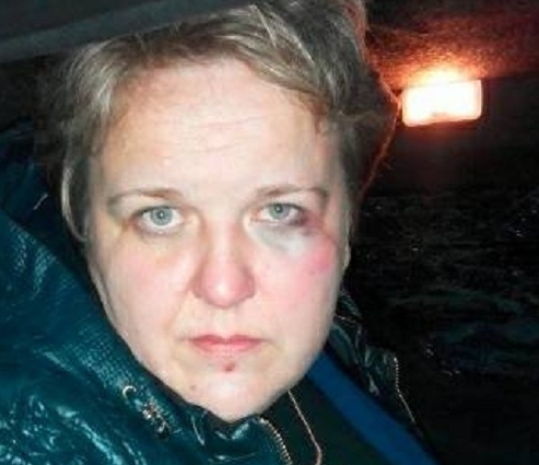 Заметки телезрителя: почему горят машины в Коцюбинском (фото, видео)