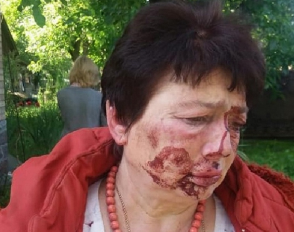 Заметки телезрителя: почему горят машины в Коцюбинском (фото, видео)