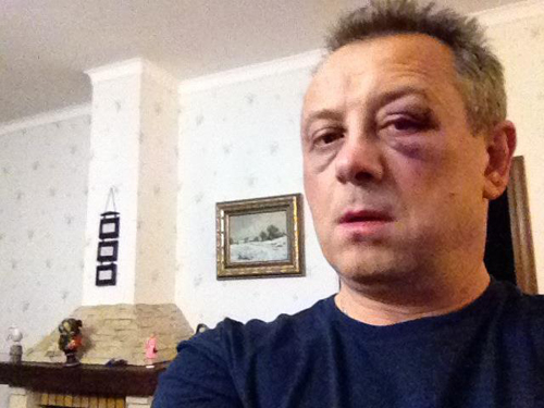Неизвестные в Киеве избили нардепа Неизвестные в Киеве избили нардепа
