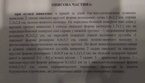 Экспертиза подтвердила - несовершеннолетнего по делу нападения на магазин “Roshen” били (ФОТО)