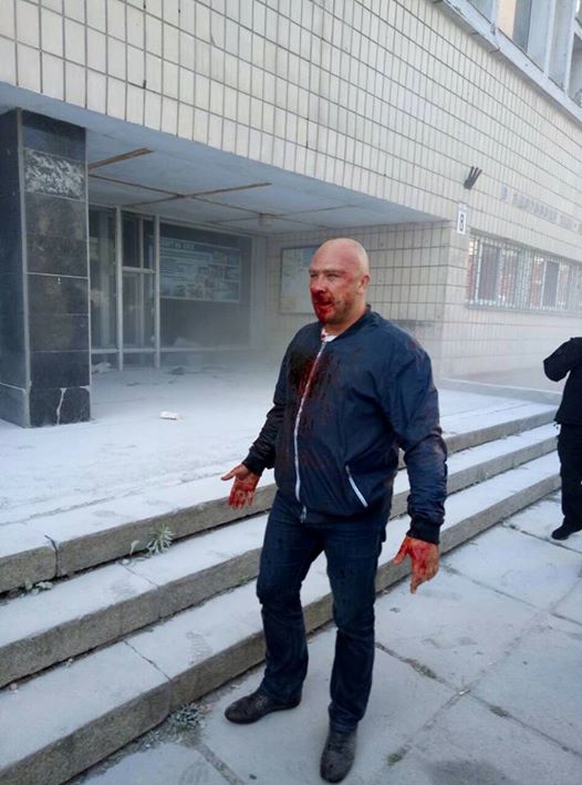 В Киеве пытались захватить спорткомплекс “Восход”, есть раненые и задержанные (фото)