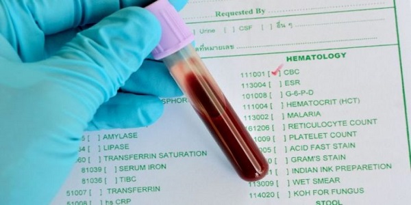 На Киевщине начато бесплатное скрининговое исследование гликированного гемоглобина для больных сахарным диабетом