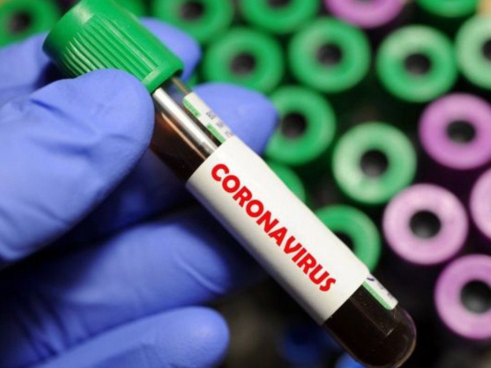 Обнародованы данные о количестве заболевших коронавирусом в Киевской области