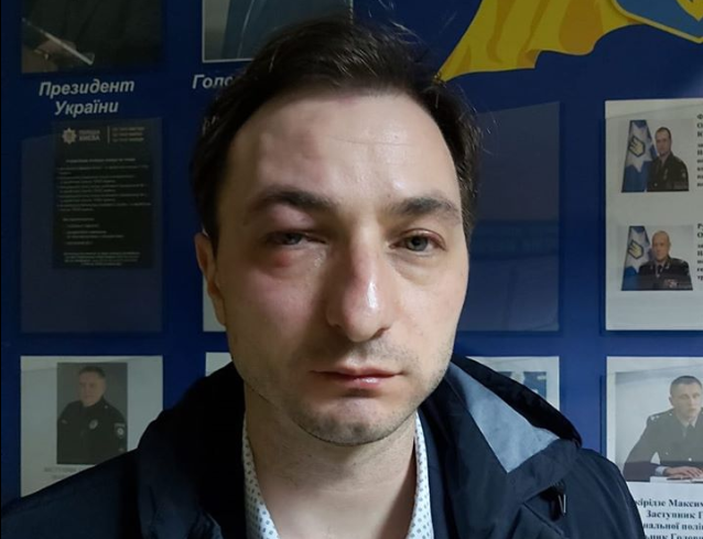 В Киеве неизвестные напали на главного врача Национального института рака (фото, видео)
