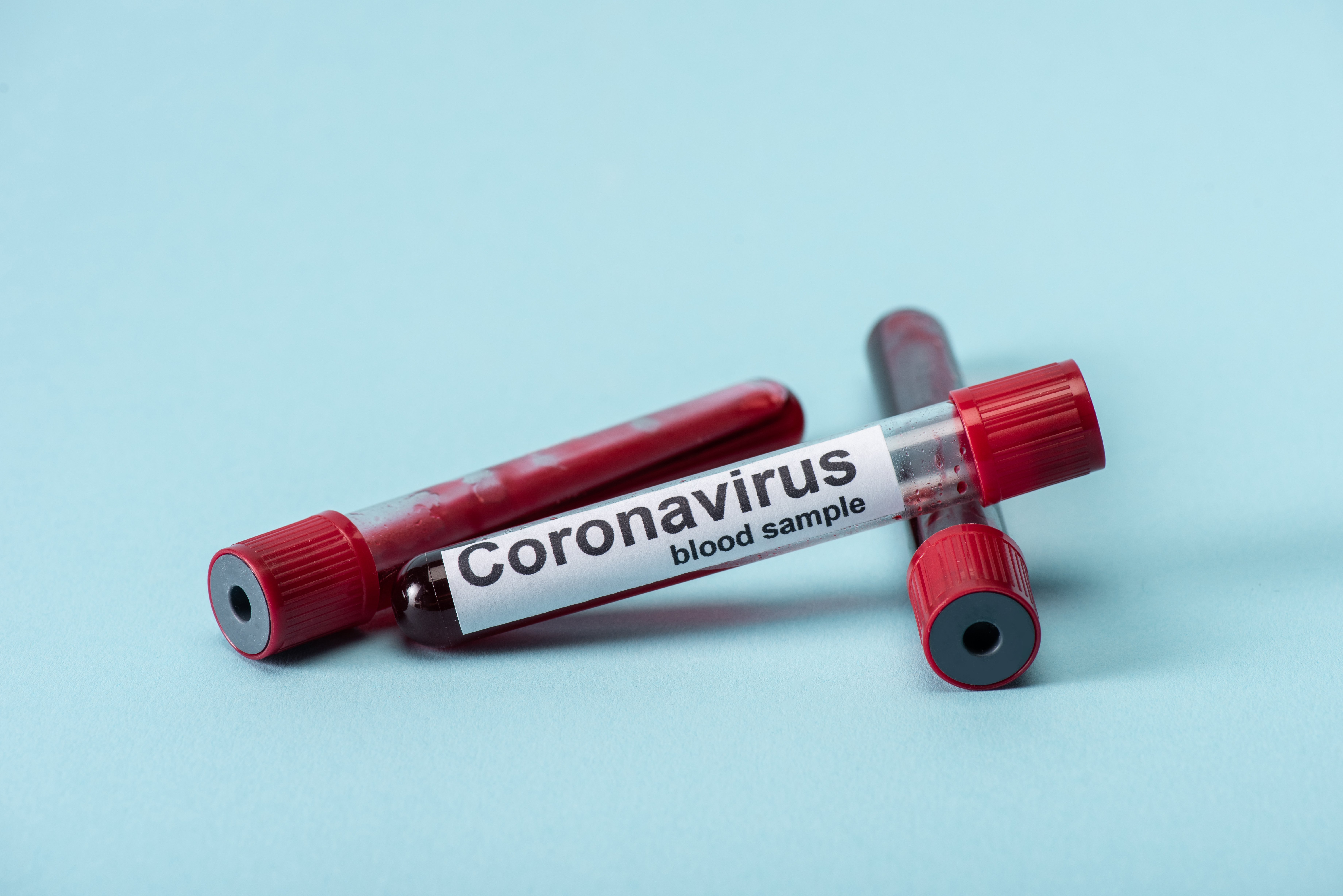 Кличко попросили отчитаться о целесообразности доставки из Китая малочувствительных экспресс-тестов на коронавирус