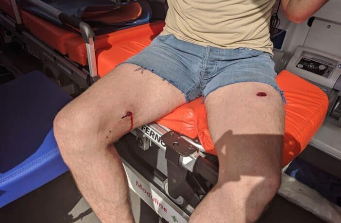 Депутату Броварского райсовета Игорю Фирсову за якобы избиение палкой ребенка прострелили ногу (фото)