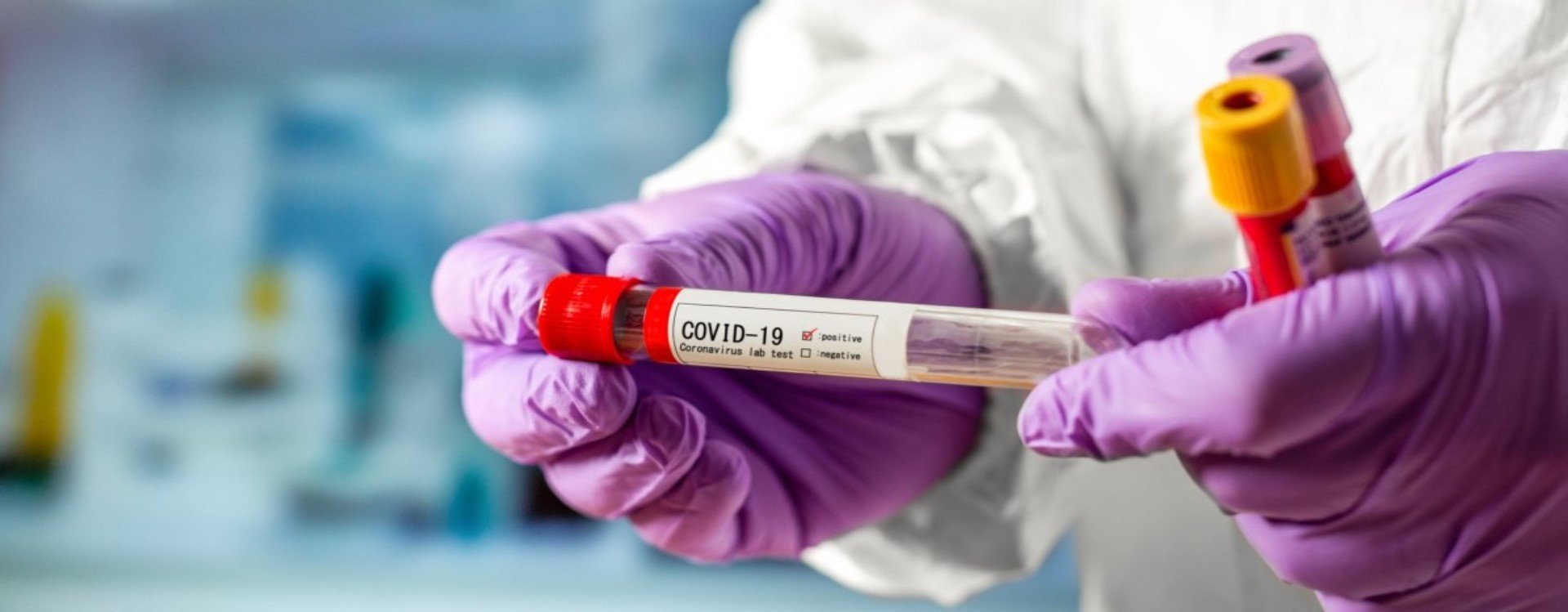 В Украине на следующей неделе появятся новые экспресс-тесты на коронавирус