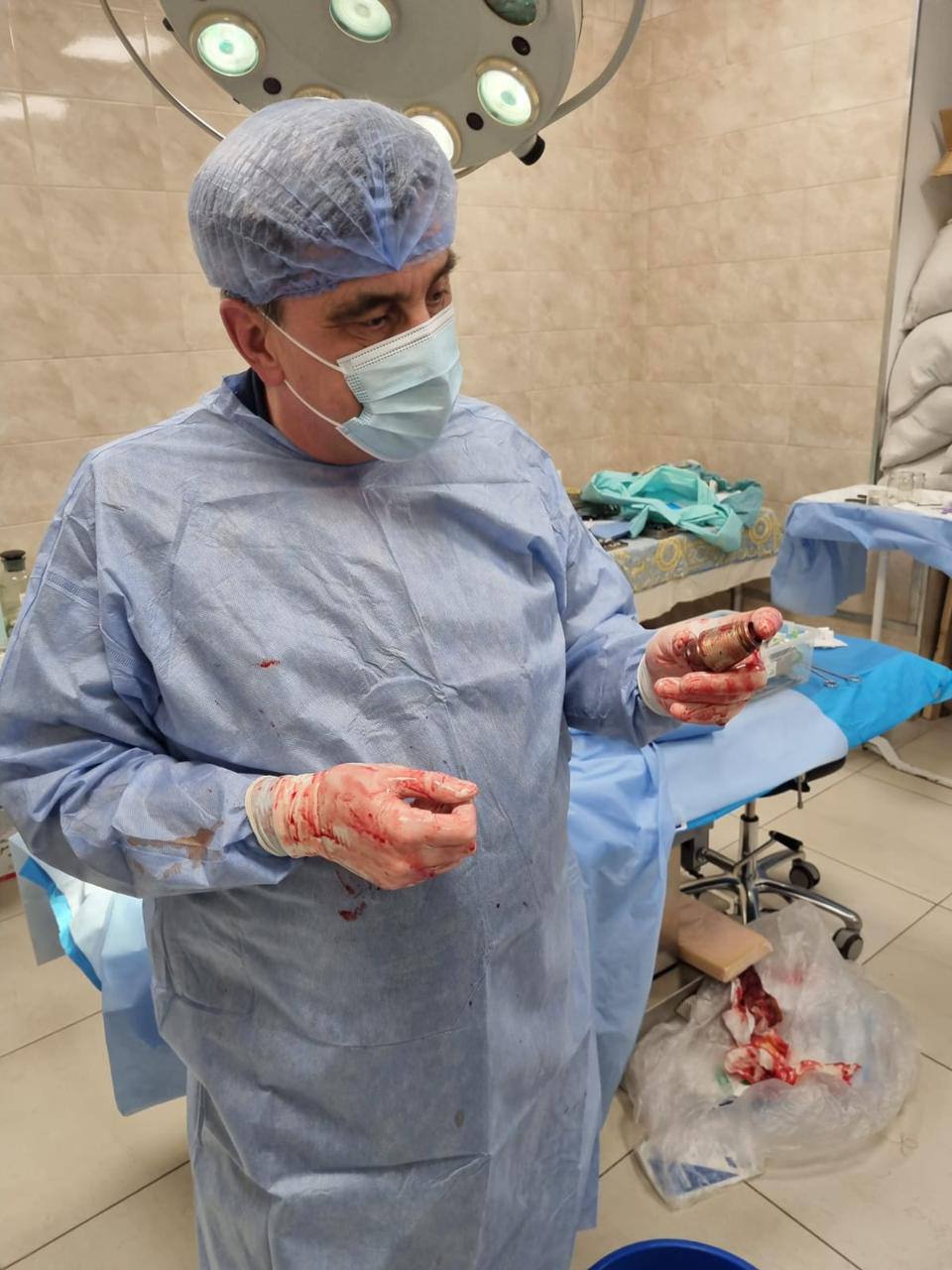 Військові лікарі провели унікальну операцію: видалили гранату, яка не розірвалася, з тіла бійця