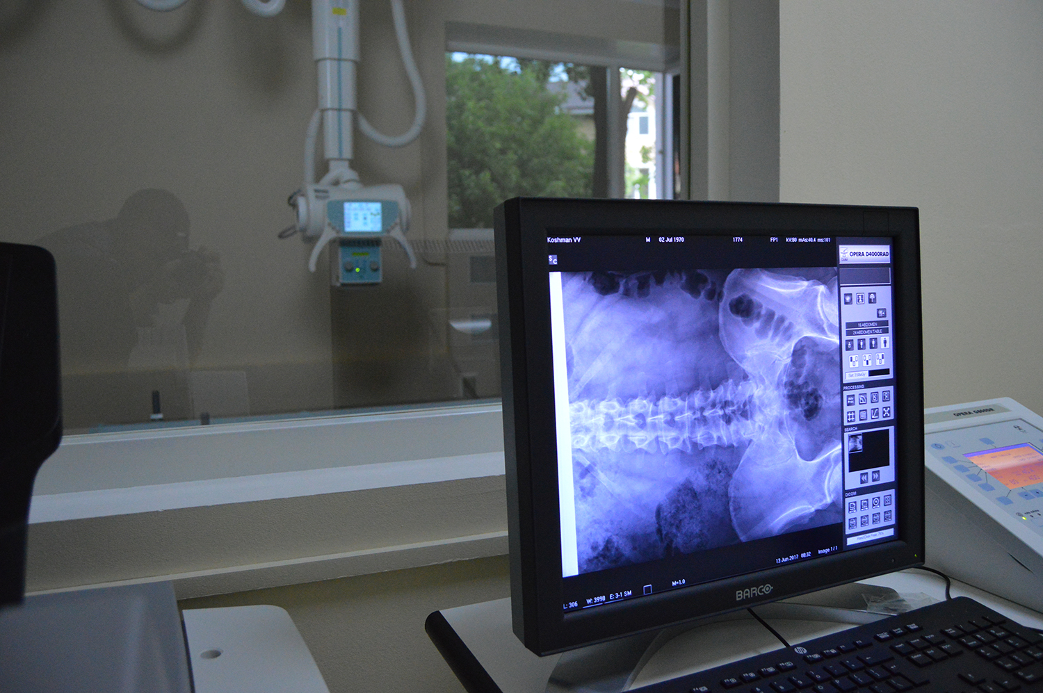 Ірпінська міська лікарня спрямовує майже 6 млн гривень на рентгенологічну систему