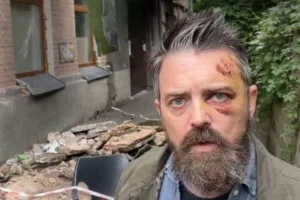 У Києві впав балкон на американського документаліста, в КМВА грішать на управляючу компанію будинку