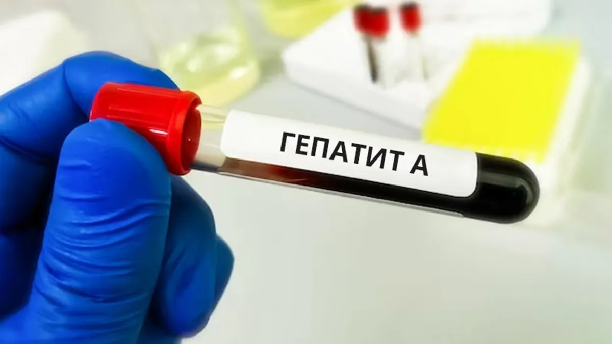 У Києві через спалах гепатиту A госпіталізовано понад 30 людей