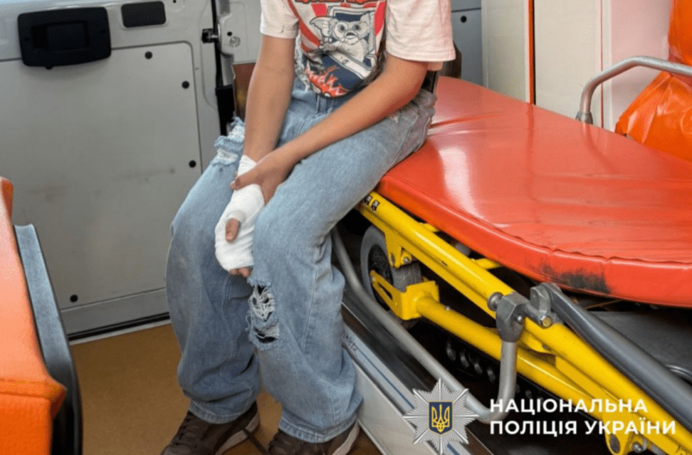 На Київщині підліток обпікся батареєю від «шахеда»