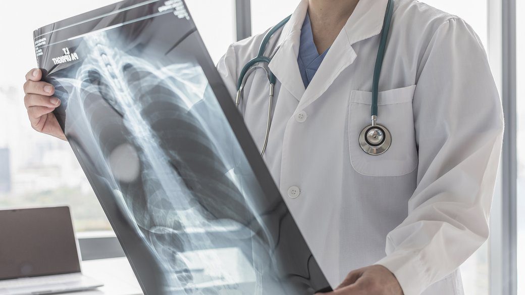 На Вишгородщині поборються з туберкульозом за пів мільйона гривень