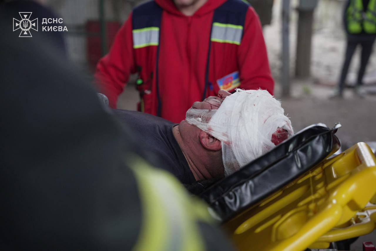 В Україні понад 70 поранених внаслідок атаки рф, у Києві число постраждалих зросло до 14