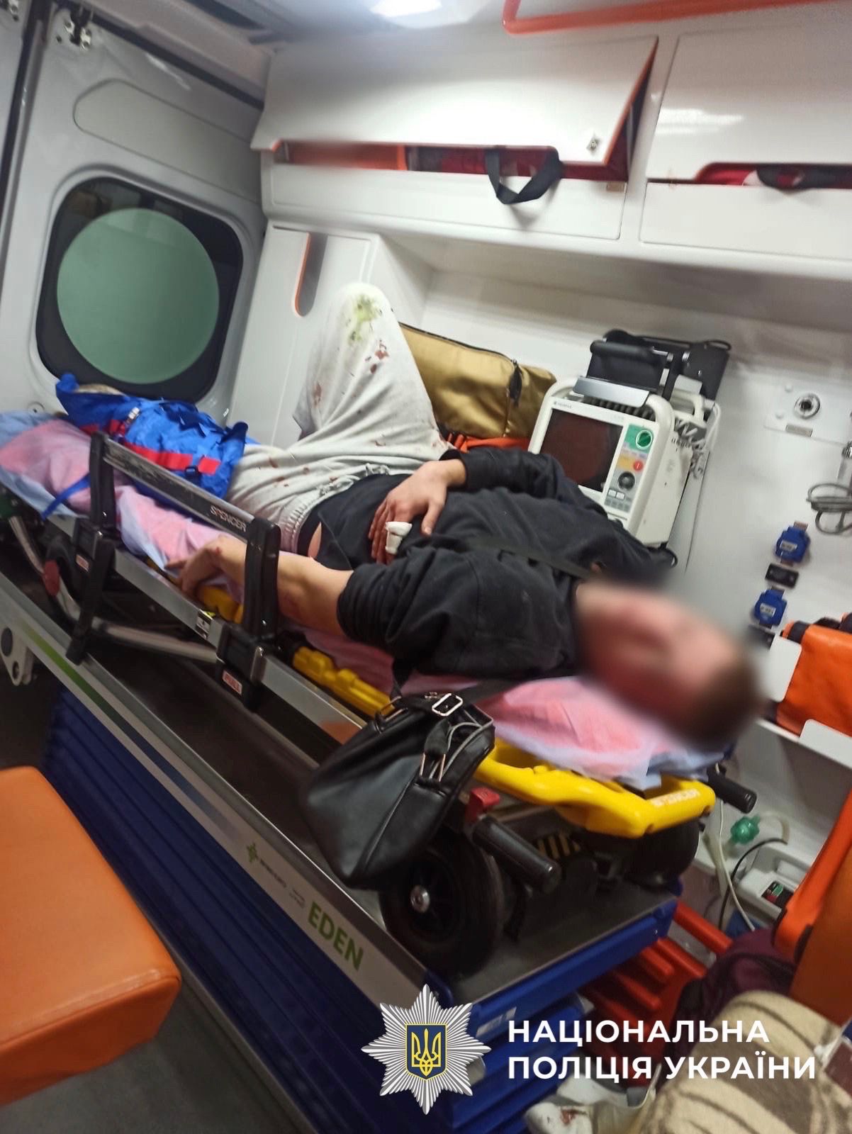 У Києві молодик пирнув ножем перехожого, який відмовив пригостити його сигаретою