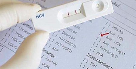 У понеділок кияни можуть безкоштовно перевіритися на ВІЛ і вірусні гепатити