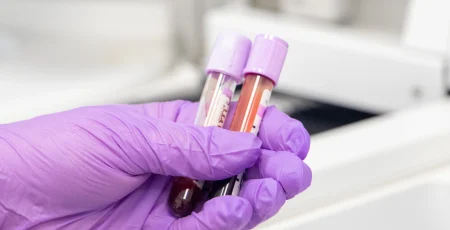 У столиці протягом тижня госпіталізували 181 хворого на грип і ГРВІ, зокрема 137 дітей