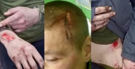 Журналісти дізналися про щонайменше 26 небойових смертей новобранців штурмового полку "Скеля" за кілька місяців, - ЗМІ